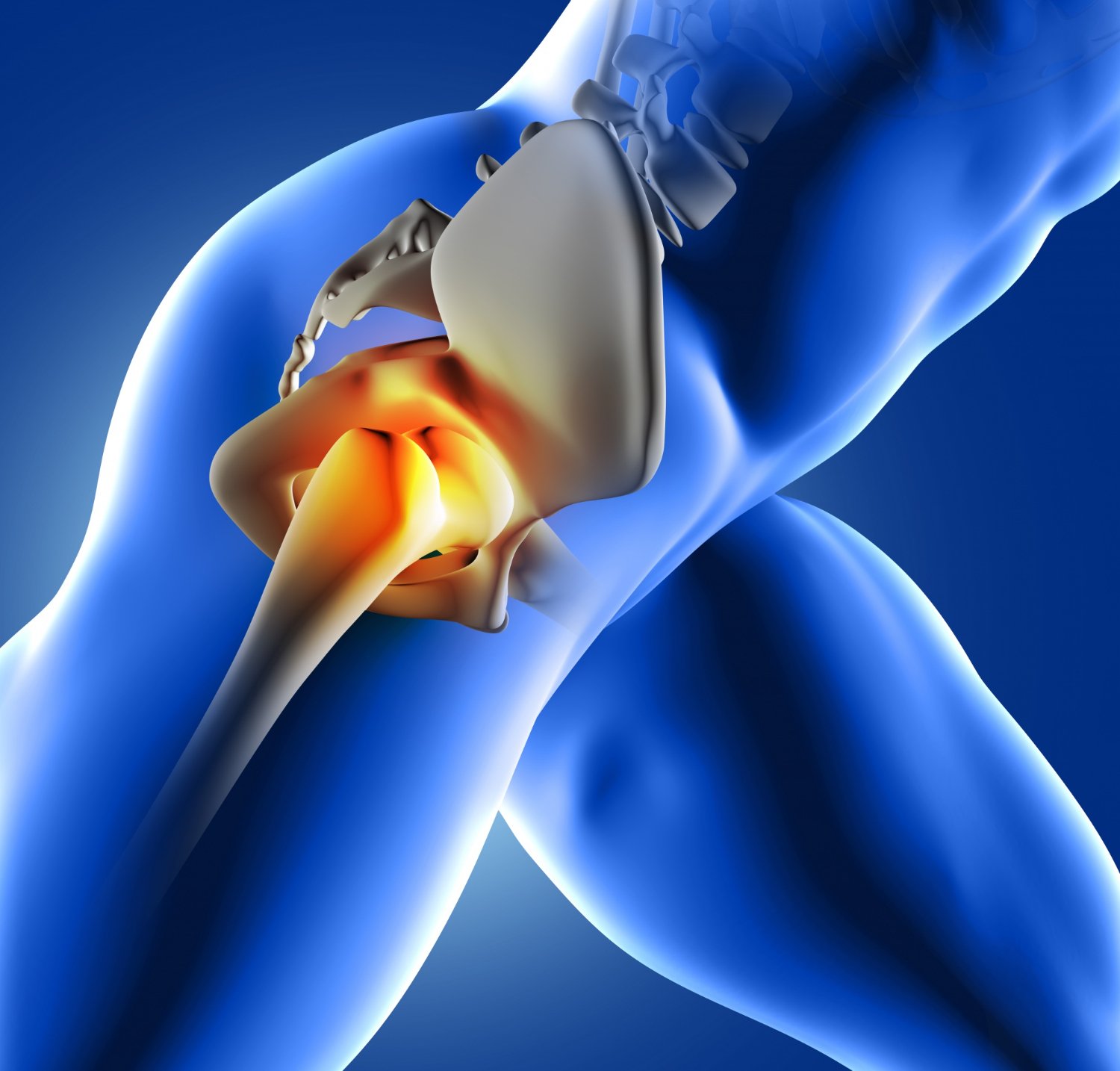 Hip Replacement Surgery in Indore: What You Need to Know Before Deciding